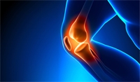 The trust in knee replacement surgery