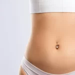 Abdominoplasty